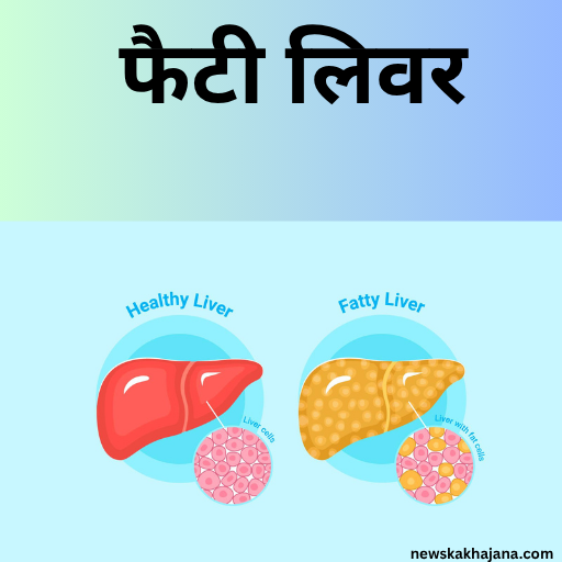 फैटी लीवर